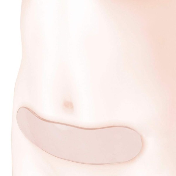 Lamina gel post cirugía abdominal Gelymer