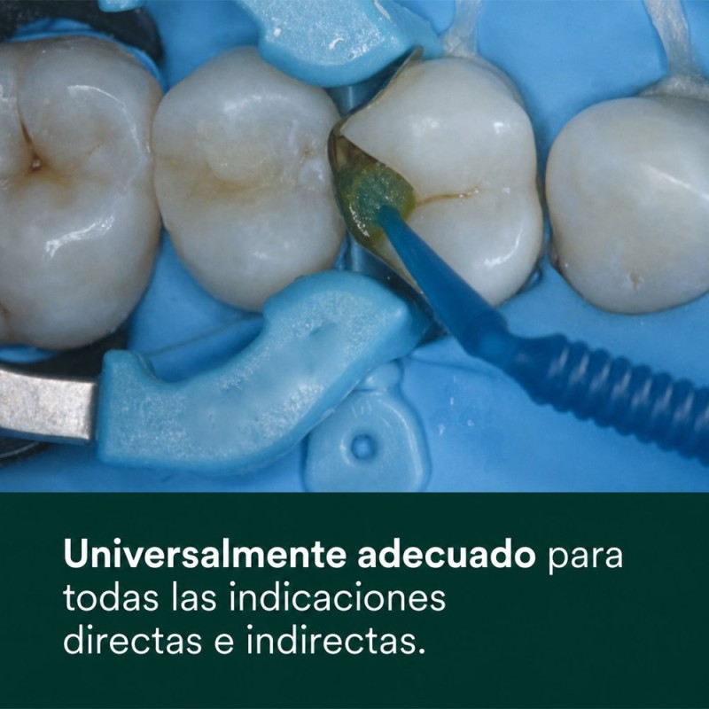 Adhesivo Universal 3M Scotchbond Universal Plus para indicaciones directas e indirectas